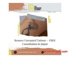 Remove Unwanted Tattoos — FREE Consultation in Jaipur