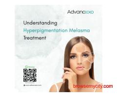 Understanding Hyperpigmentation Melasma Treatment