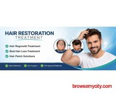 Best Hair Restoration Treatment | Apolo Hair Studio – Hair Regrowth & Hair Patch Solutions