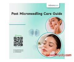 Post Microneedling Care Guide