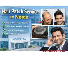 Apolo Hair Studio: Top Hair Patch Service in Noida for Hair Loss