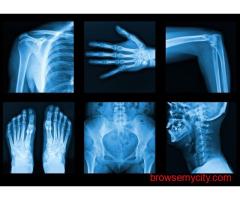 OPG X-Ray Near Me in Delhi – SVMC Digital Imaging
