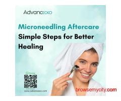 Microneedling Aftercare: Simple Steps for Better Healing