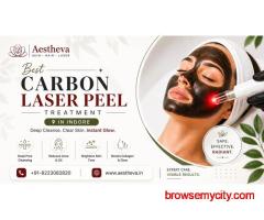 Best Carbon Laser Peel Treatment in Indore – Aestheva
