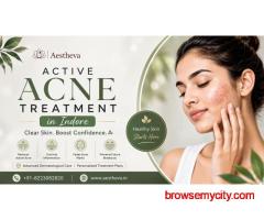 Active Acne Treatment in Indore – Aestheva
