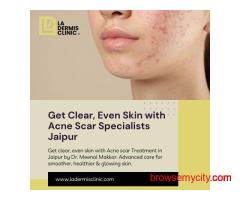 Get Clear, Even Skin with Acne Scar Specialists Jaipur
