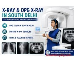 X-Ray in South Delhi – Advanced Digital Imaging Services