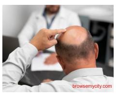 Effective Hair Transplant Solutions in Varanasi