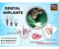 DR. SHAILAJA REDDY | BEST IMPLANTOLOGIST IN HYDERABAD, INDIA