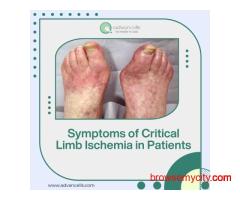 Symptoms of Critical Limb Ischemia in Patients