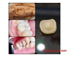 Looking for Dental Implants in Barasat? Get Full Mouth Reconstruction Arch Treatment at Ivory32