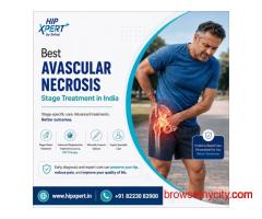 Best Avascular Necrosis Stage Treatment in India – HipXpert