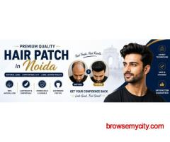 Hair Patch in Noida - Best Hair Replacement Clinic | Apolo Hair Studio