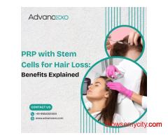 PRP with Stem Cells for Hair Loss: Benefits Explained