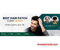 Best Hair Patch Clinic in Noida | Apolo Hair Studio