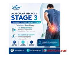 Avascular Necrosis Stage 3 Treatment without Surgery in India – HipXpert
