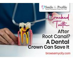 Complete Your Smile, Restore Your Confidence