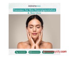Exosomes for Skin Hyperpigmentation and Skin Glow