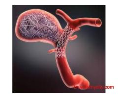 Coiling Treatment for Brain Aneurysm | Minimally Invasive Care
