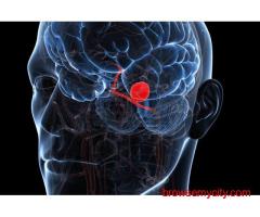 Brain Coiling Treatment for Aneurysm | Advanced Minimally Invasive Care in India