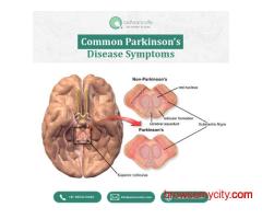 Common Parkinson’s Disease Symptoms