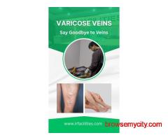 For Varicose Vein Which Doctor? Varicose Veins Doctors Treatment