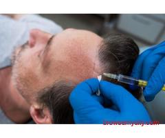 FUE vs. FUT: Comparing Hair Transplant Techniques | Hair Aesthetica
