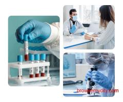 Lipid Profile Test in Hyderabad – Check Your Cholesterol Levels
