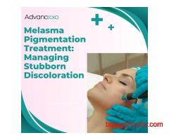 Melasma Pigmentation Treatment: Managing Stubborn Discoloration