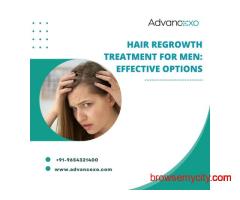 Hair Regrowth Treatment for Men: Effective Options