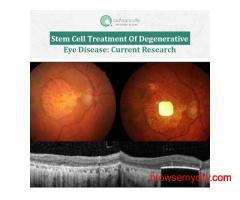 Stem Cell Treatment of Degenerative Eye Disease: Current Research