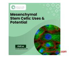 Mesenchymal Stem Cells: Uses and Potential