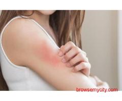 Itching Treatment in Ghatkopar