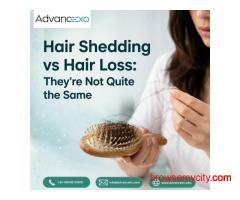 Hair Shedding vs Hair Loss: They're Not Quite the Same