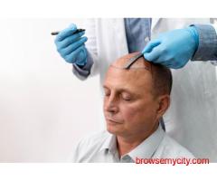 Best Hair Doctor In Varanasi | FUE Hair Transplant & DHT Specialist