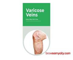 Varicose Veins Laser Treatment Cost in India – Treatment Guide