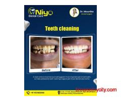 Best teeth cleaning in hanamkonda and warangal