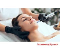 Expert Microneedling Treatment in Reading | Purely Pampered